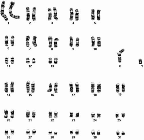 horse karyotype